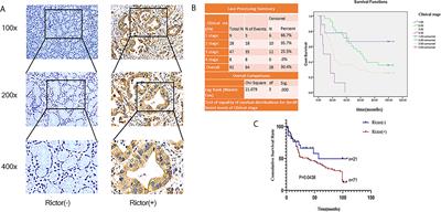 Rictor Activates Cav 1 Through the Akt Signaling Pathway to Inhibit the Apoptosis of Gastric Cancer Cells